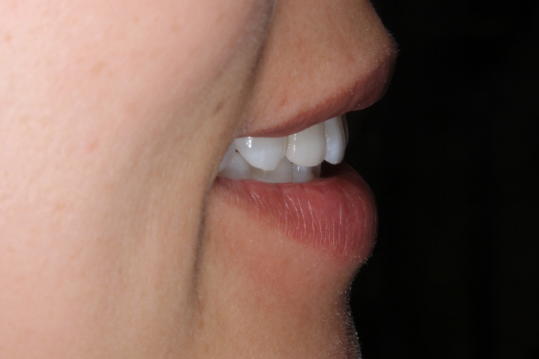 口腔内・お口全体のお写真の一例 05